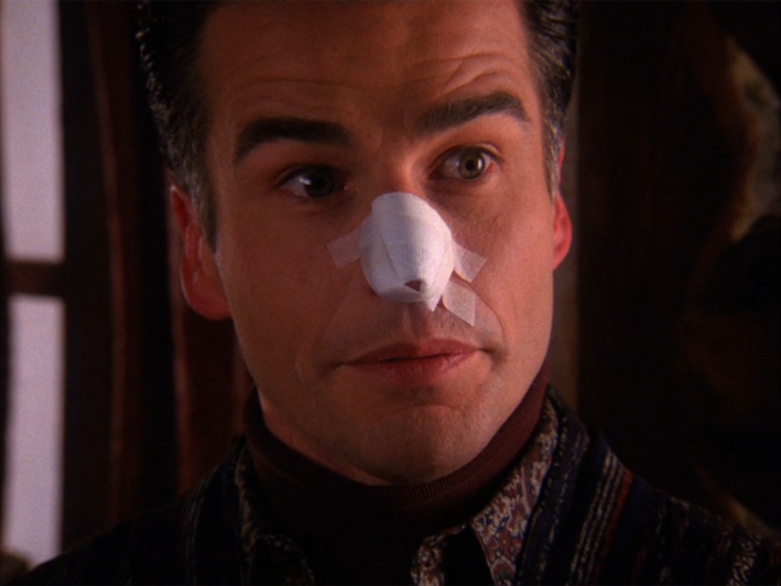 Dick with broken nose